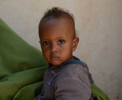 10-month-old Hussein used to be malnourished.