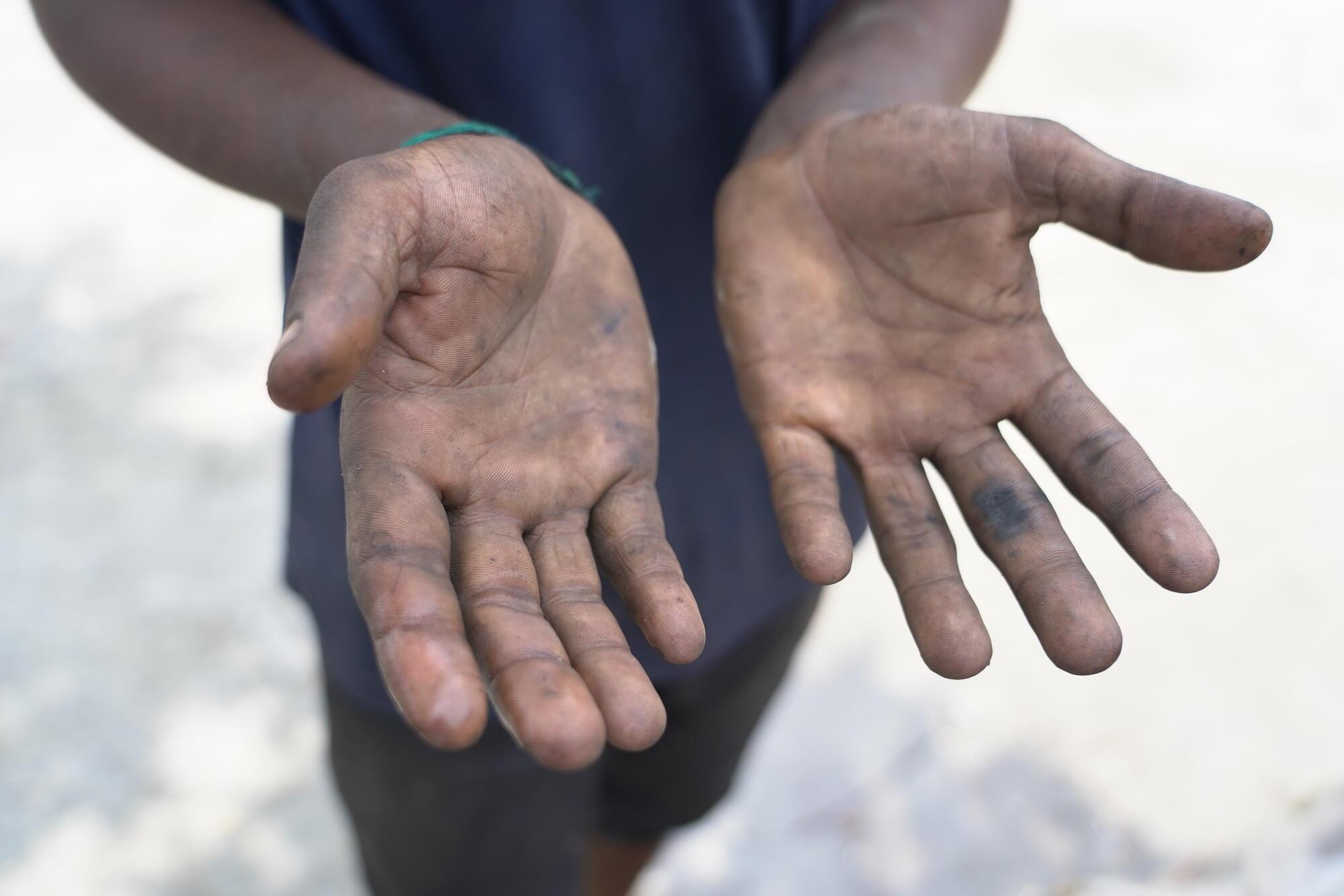 Dirty hand of Sajal after servicing a motor bike in the workshop.